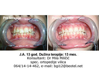 DENTAL ORDINATION BREKET Dental surgery Belgrade - Photo 5