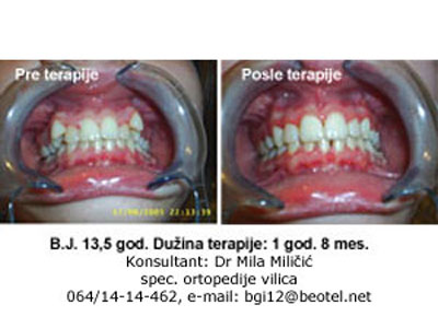 DENTAL ORDINATION BREKET Dental surgery Belgrade - Photo 6
