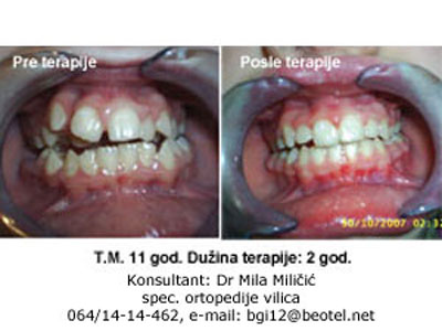 DENTAL ORDINATION BREKET Dental surgery Belgrade - Photo 7