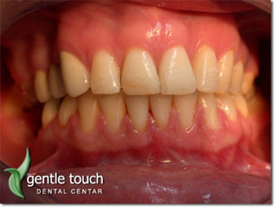 DENTAL GENTLE TOUCH Dental surgery Belgrade - Photo 9