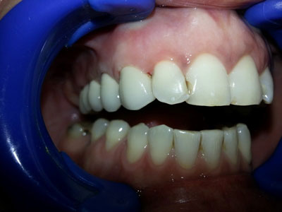 DENTAL GENTLE TOUCH Dental orthotics Belgrade - Photo 2
