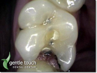 DENTAL GENTLE TOUCH Dental orthotics Belgrade - Photo 4