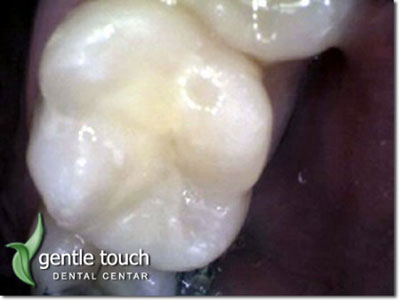 DENTAL GENTLE TOUCH Dental orthotics Belgrade - Photo 5
