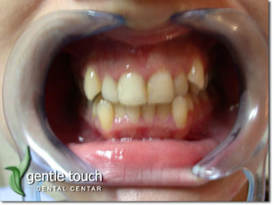 DENTAL GENTLE TOUCH Dental surgery Belgrade - Photo 6