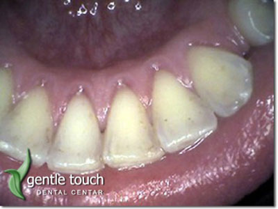 DENTAL GENTLE TOUCH Dental orthotics Belgrade - Photo 7