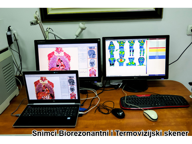 AS MEDICUS BIOREZONANCA - POLIKLINIKA Ultrazvučna dijagnostika Beograd - Slika 2