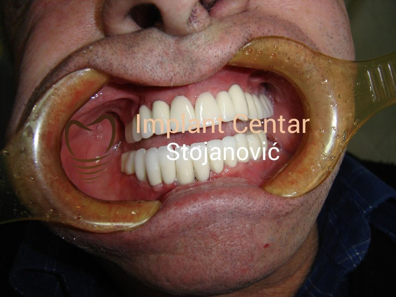 BRANISLAV STOJANOVIC - IMPLANT CENTER Dental surgery Belgrade - Photo 7