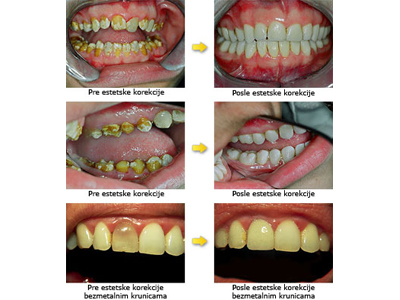 KORONA SPECIALISTIC DENTAL SURGERY Dental orthotics Belgrade - Photo 2
