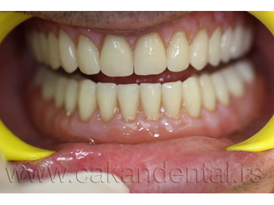 CAKAN DENTAL LAB Dental tehnician labotories Belgrade - Photo 12