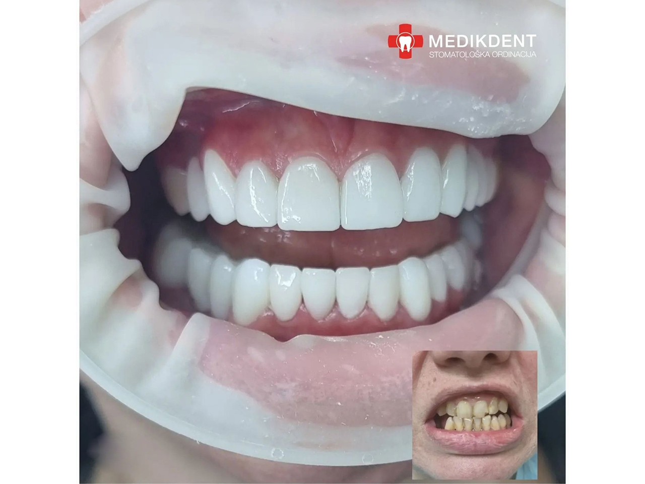 Photo 1 - MEDIKDENT DENTAL SURGERY Dental surgery Belgrade