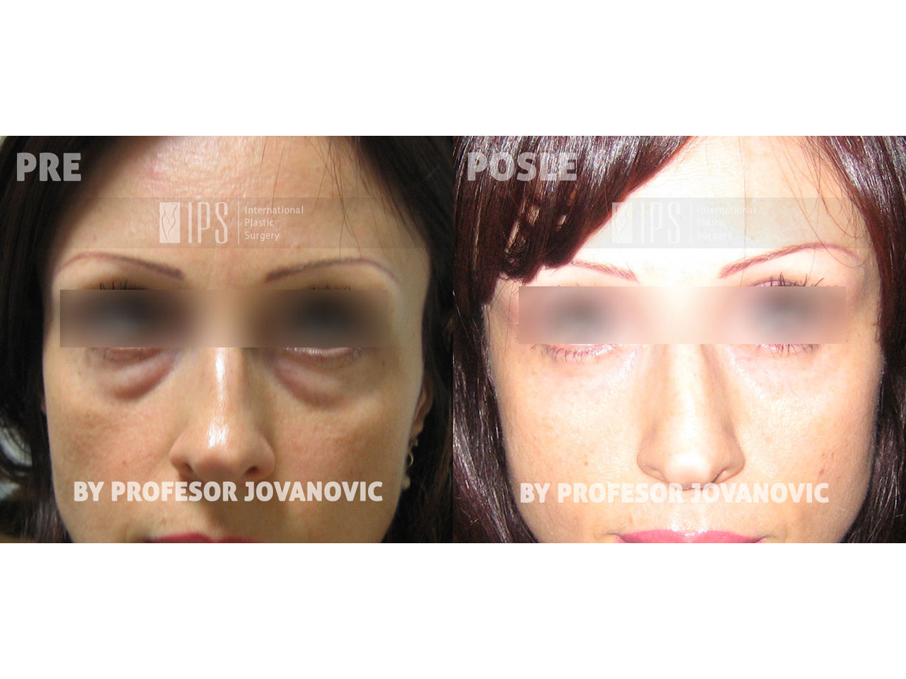 MSB - PLASTIC AND RECONSTUCTIVE SURGERY Plastic,Reconstructive Surgery Beograd