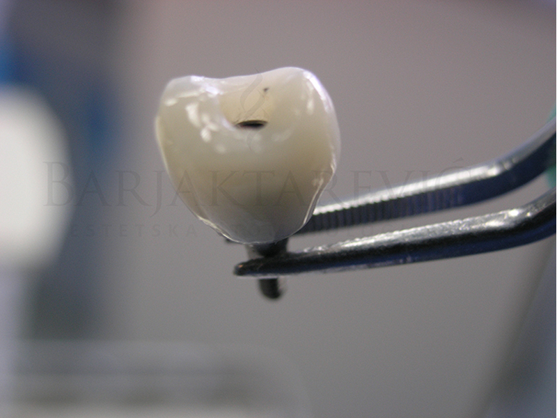 BARJAKTAREVIC ESTETIC STOMATOLOGY Dental orthotics Belgrade - Photo 11