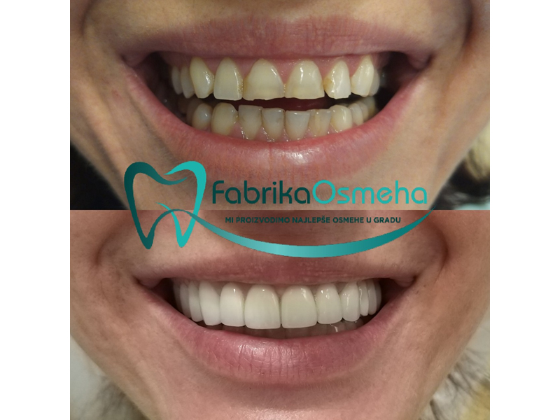 Photo 3 - SMILE FACTORY Dental surgery Belgrade