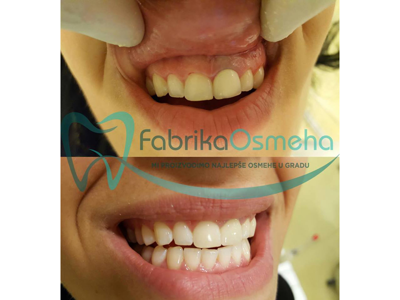 Photo 7 - SMILE FACTORY Dental surgery Belgrade