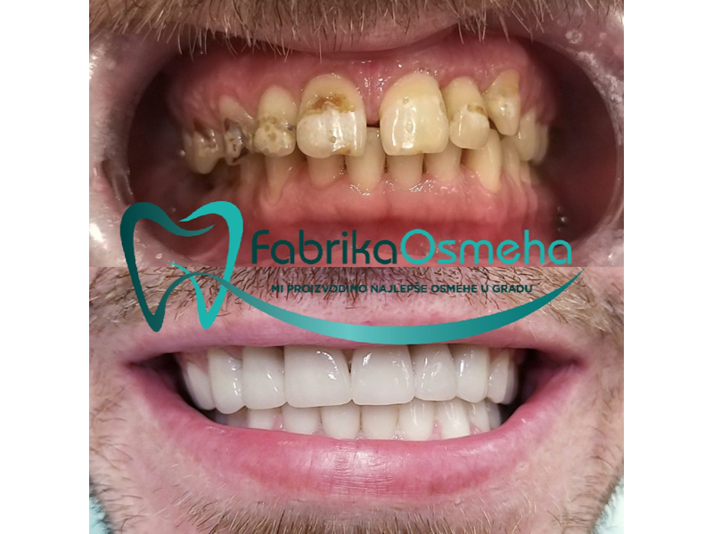 Photo 9 - SMILE FACTORY Dental surgery Belgrade