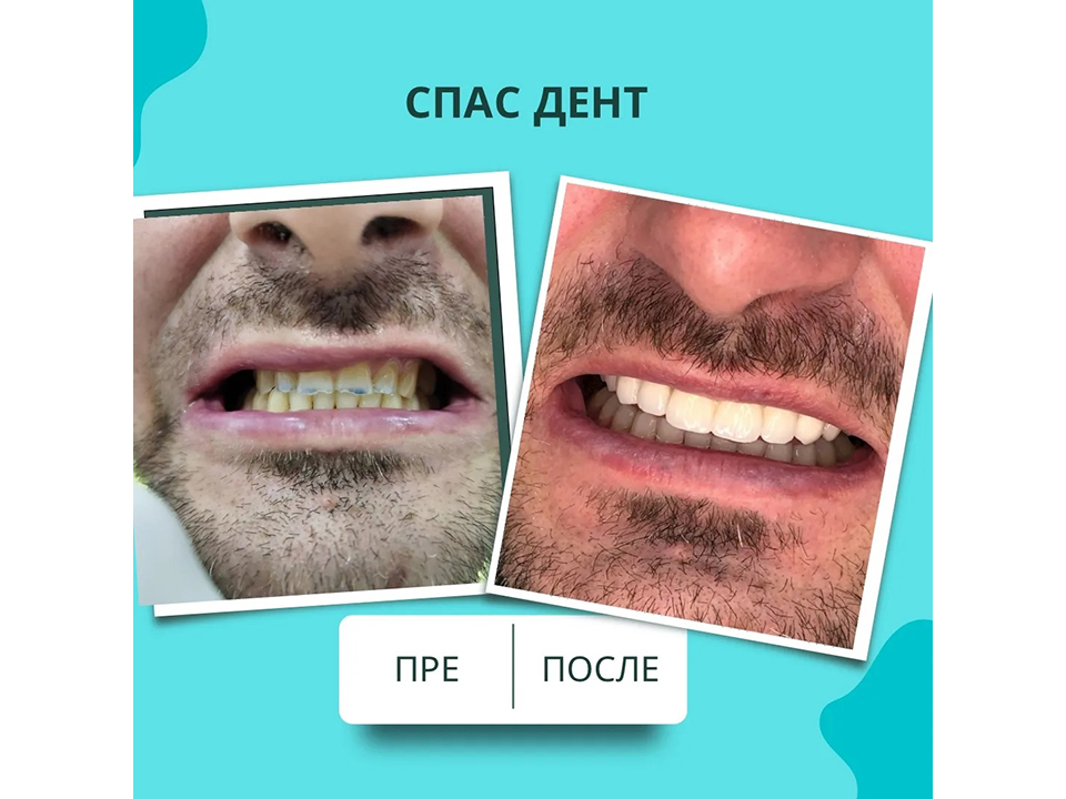 Photo 3 - SPAS DENT DENTAL OFFICE Dental surgery Belgrade