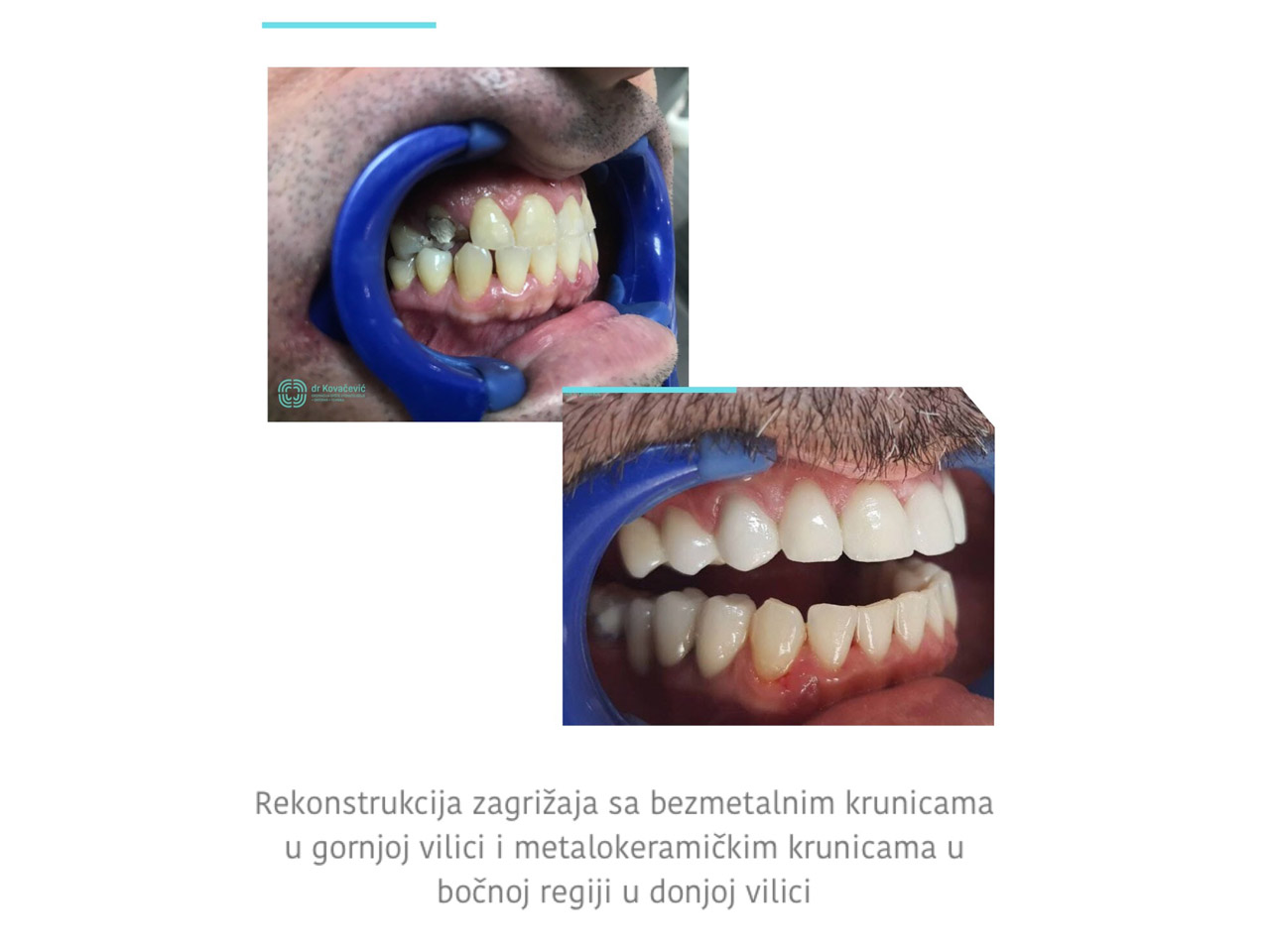 DENTAL CLINIC AND X-RAY CENTER DR KOVACEVIC Dental surgery Belgrade - Photo 10