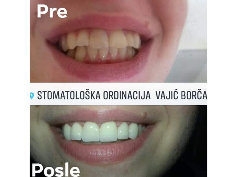 DENTAL OFFICE VAJIC Dental surgery Belgrade - Photo 6