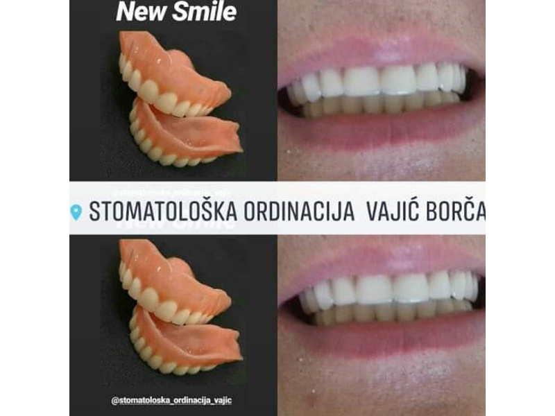 DENTAL OFFICE VAJIC Dental surgery Belgrade - Photo 7