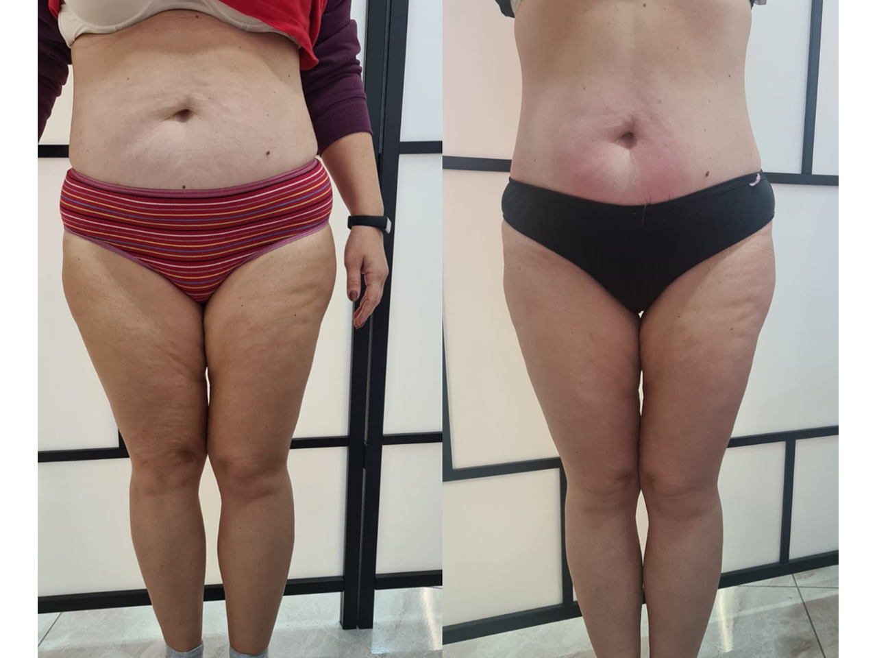 BEAUTY SERVICE Solarium Belgrade - Photo 8