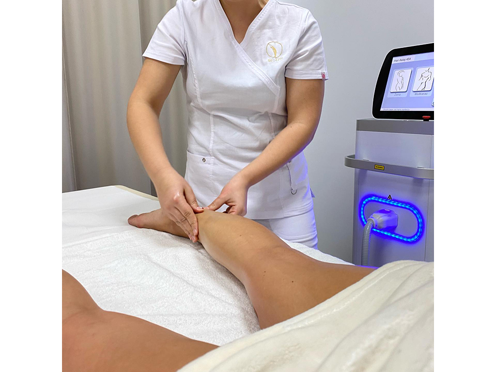 BEOEPIL Laserska epilacija Beograd - Slika 10