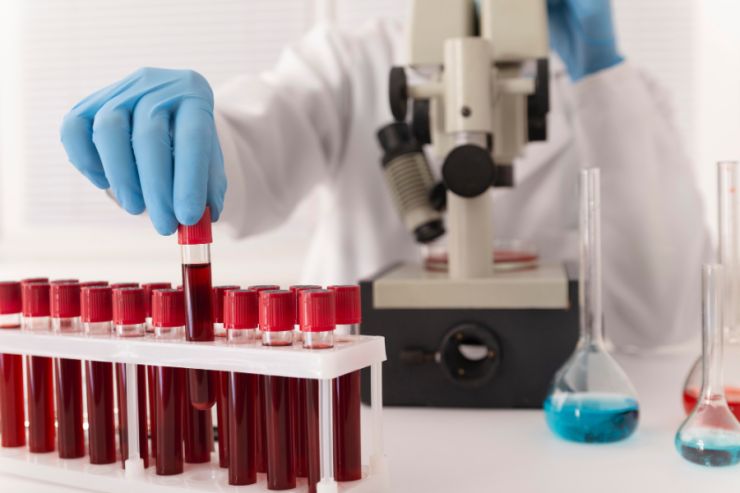 Kako da sami protumačite rezultate testa krvi